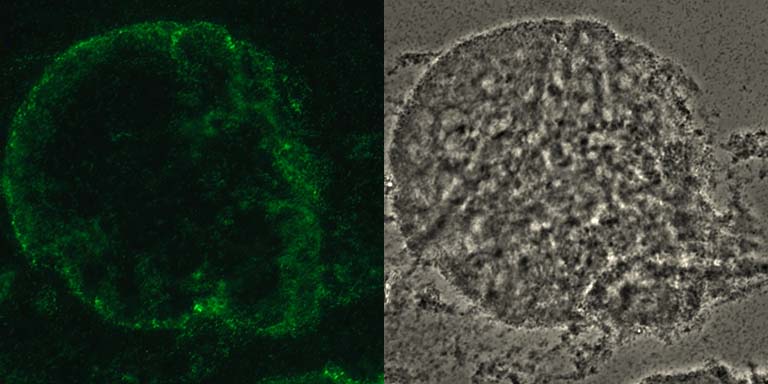 霍乱弧菌生物膜在甲壳素珠沾想象细菌细胞的DNA插入荧光染料。左:这项工作。右:相衬。